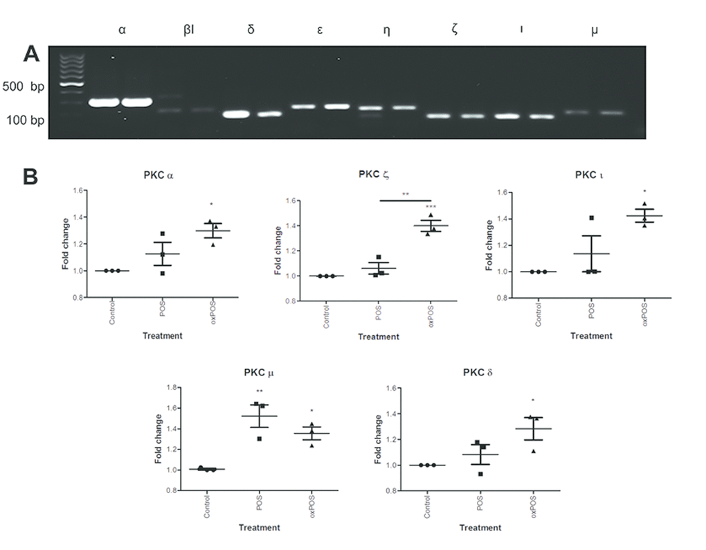 Expression of PKC isoforms in ARPE19 cells. (A) Conventional PCR gel image showing expression of eight PKC isoforms-PKCα, PKCβI, PKCδ, PKCε, PKCη, PKCζ, PKCι and PKCμ in ARPE19 cells. (B) Real-time RT-PCR analysis of PKC isoforms in ARPE19 cells following POS, oxPOS treatments and untreated control. *, P 