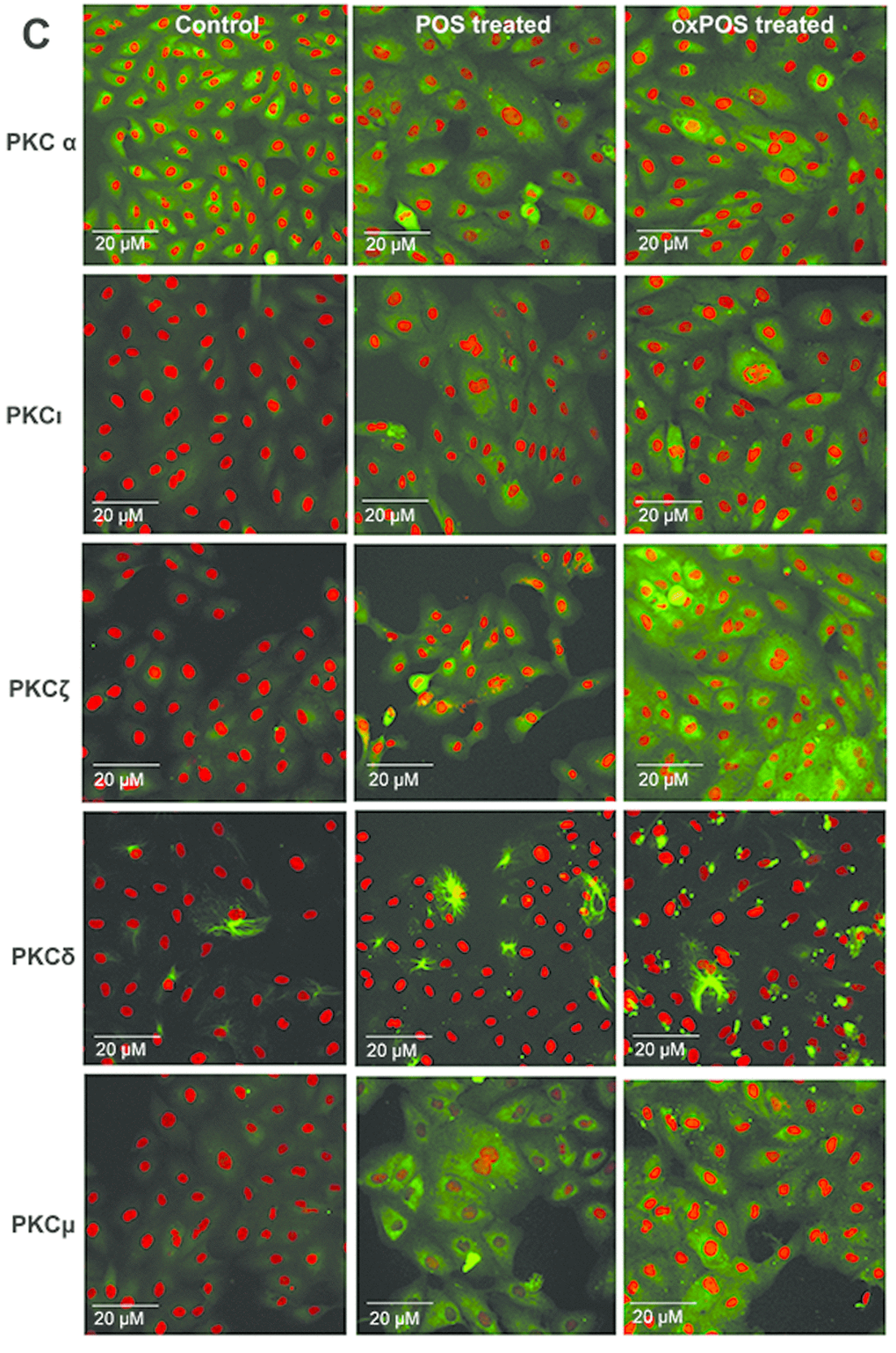 Expression of PKC isoforms in ARPE19 cells.(C) Immunofluorescent staining of PKCα, PKCδ, PKCζ, PKCι and PKCμ isoforms in RPE cells following POS or oxPOS treatments. The isoforms were in green, nuclei were labelled by PI in red.