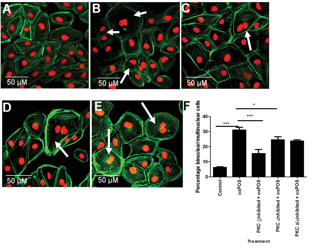 The effects of PKC isoform inhibition in RPE cell multinucleation. (A) control RPE cells. (B) oxPOS treated RPE cells. (C) PKCζ inhibited + oxPOS treated RPE cells. (D) PKCι inhibited + oxPOS treated RPE cells. (E) PKC δ/ε inhibited + oxPOS treated RPE cells. Arrows indicate multinucleate RPE cells. (F) histogram showing the percentage of binucleate/multinucleate RPE cells following different treatments *, P 