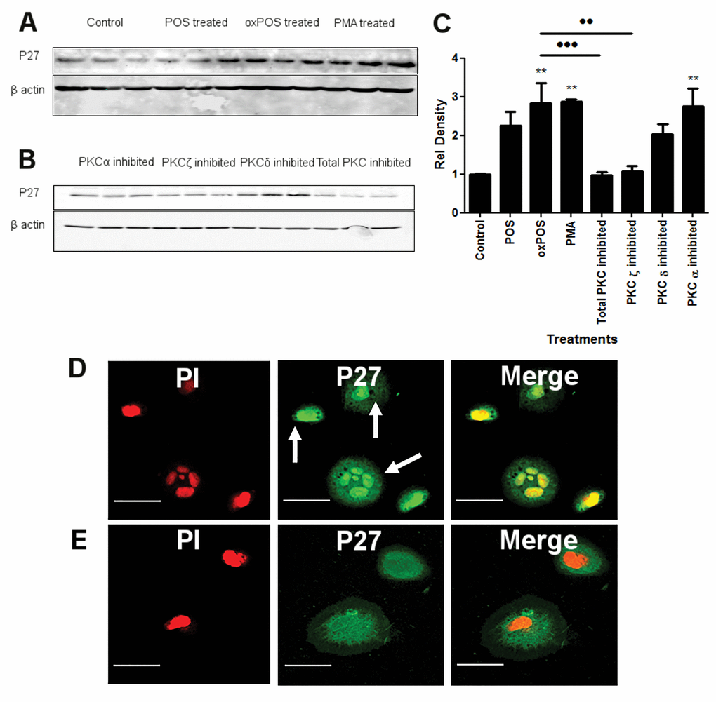 The effect of PKC inhibition on P27kip1 expression in RPE cells. (A-B) representative Western blots from control, POS, oxPOS, PKCα, ζ, δ and total PKC inhibitor treated RPE cells showing p27kip1 at 28 KDa and β-actin at 40 KDa. (C) quantification of p27kip1 expression by RPE cells in the different groups. Data were expressed as relative fold change to the control. *, P D) ARPE-19 cells were stained for p27kip1 (green) and PI (red) after 48 h oxPOS treatment. Arrows shows strong p27kip1 staining in cell nucleus. (E) control ARPE-19 cells stained for p27kip1 (green) and PI (red) showing weak, diffused p27kip1 (green) in the cytoplasm and nucleus.