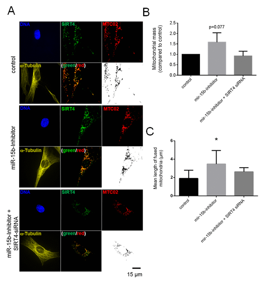 SIRT4 upregulation through miR-15b inhibition increases L-OPA1 levels and promotes mitochondrial fusion in fibroblasts. (A) Primary human dermal fibroblasts were transfected with miR-15b inhibitors (or control oligonucleotides) in the presence or absence of siRNA duplexes against SIRT4 [35] followed by subcellular visualization of SIRT4 (green), MTC02 (red), and α-Tubulin (yellow) after four days. The mitochondrial profiles (MTC02; black/white) were further visualized as binary confocal pictures. Cellular morphology/size was defined by α-Tubulin staining. Representative images are depicted. (B) Quantification of the mitochondrial mass via MTC02 staining analysis using ImageJ software (Material & Methods and suppl. Material & Methods). (C) Quantitative analysis of mitochondrial fusion/length of mitochondrial tubes (as exemplified in Suppl. Fig. 6) using ImageJ software (Material & Methods and suppl. Material & Methods). To evaluate statistical significance, two-way ANOVA followed by Tukey’s test was performed (*p