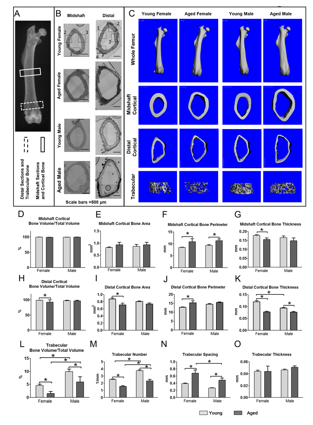 Aging is associated with structural changes in bone that are more pronounced in females than males. (A) X-ray of mouse femur showing regions used for midshaft cortical and distal cortical and trabecular analysis. (B) Bright field montaged images of midshaft and distal sections used for confocal imaging of 5 and 22mo mouse femurs with imaging regions indicated by numbered black boxes (Bars = 500μm). (C) MicroCT reconstructions for whole femurs and midshaft cortical and distal cortical and trabecular bone. Graphs in (D-G) show microCT quantitation of midshaft cortical bone parameters, (H-K) show distal cortical bone parameters and (L-O) show quantitation of trabecular bone parameters in young and aged mice. (Data are mean ± SEM, * = p 0.05, ANOVA/Tukey’s, females n= 8, males n= 6-7) (Note: n=6 was used for the aged female group in graphs (M-O) because in two aged females the trabecular number was so low that the software cannot reliably compute values for trabecular spacing).