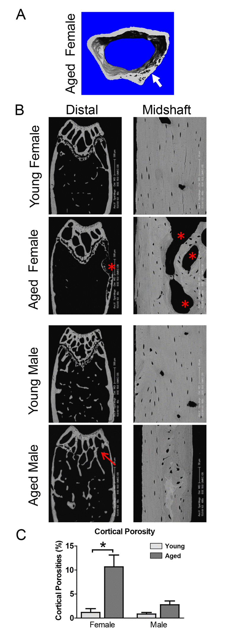 Aging is associated with cortical porosities, regional variation in mineral density and growth plate closure. (A) microCT reconstruction of distal femur cortical bone in an aged female showing cortical porosity (arrow). (B) BSEM image of the distal femur (Bar = 500μm) and midshaft cortical bone (Bar = 50μm) in young and aged C57BL/6 mice. Arrow indicates growth plate closure in the aged male and * indicates cortical porosities. (C) Quantitation of cortical porosity from n=5 animals showing a significant increase in cortical porosity in female C57BL/6 mice with age.
