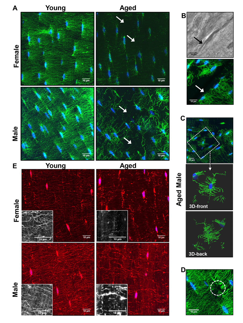 Degeneration of the osteocyte network in aged bone. (A) Maximal Z-projections of 250 planes (32.5μm) from 100x confocal images of phalloidin (green) and DAPI (blue) stained midshaft femur sections showing osteocyte connectivity in young and aged male and female mice. (B) Dendrites do not cross over discontinuities in the bone (arrow) although matrix is present as seen in the corresponding brightfield image. (C) Some osteocytes in aged animals are found in “islands” with few or no connections to the surrounding osteocytes (dashed box). Enlarged images in (C) show a 3D render (front and back) of the same osteocyte confirming its lack of connectivity with surrounding osteocytes. (D) Occasionally dendrites with no visible cell body were seen in the aged mice (dashed circle) suggesting the dendrites may be left behind after apoptosis. (E) Maximal Z-projections of 20 planes (2.6μm) from DiI (red) and DAPI (blue) labeled femur sections showing staining of the osteocyte cell membrane in young and aged mice. Black and white insets show lipid material in the matrix around the dendrites. (Bars = 10μm).
