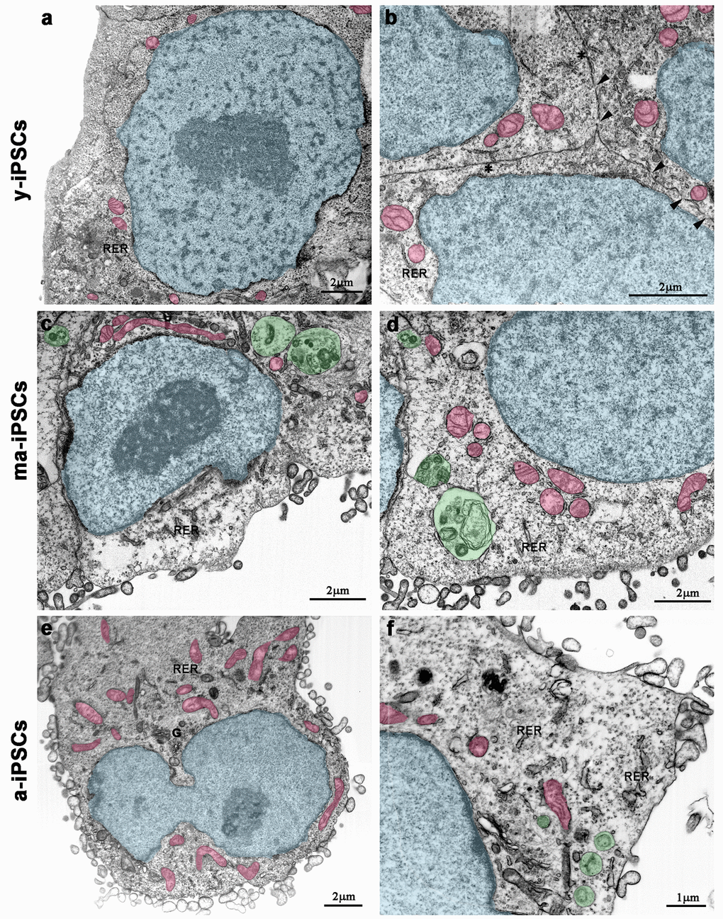 FIB/SEM micrographs of y-iPSCs (a,b), ma-iPSCs (c,d) and a-iPSCs (e,f). Images have been electronically colored to highlight nuclei (in blue), mitochondria (in pink), and autophagosomes (in green). Arrowheads, gap junctions; asterisks, tight junctions; G, Golgi apparatus; RER, rough endoplasmic reticulum.