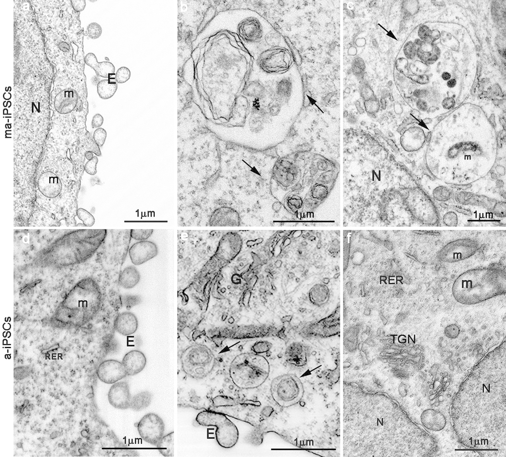 FIB/SEM images showing ultrastructural details of ma- (a-c) and a-iPSCs (d-f). Arrows in b,c,e indicate autophagosomes containing mitochondria (m) or other partially digested cytoplasmic material. E, exosomes; N, nuclei; (TGN, trans-Golgi network; RER, rough endoplasmatic reticulum).