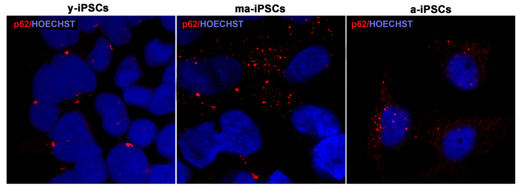 Confocal microscopic images of y-, ma- and a-iPSCs marked with p62 (in red) and Hoechst (in blue) showing abundant granular p62 immunopositivity in ma-iPSCs and in a-iPSCs when compared with y-iPSCs.