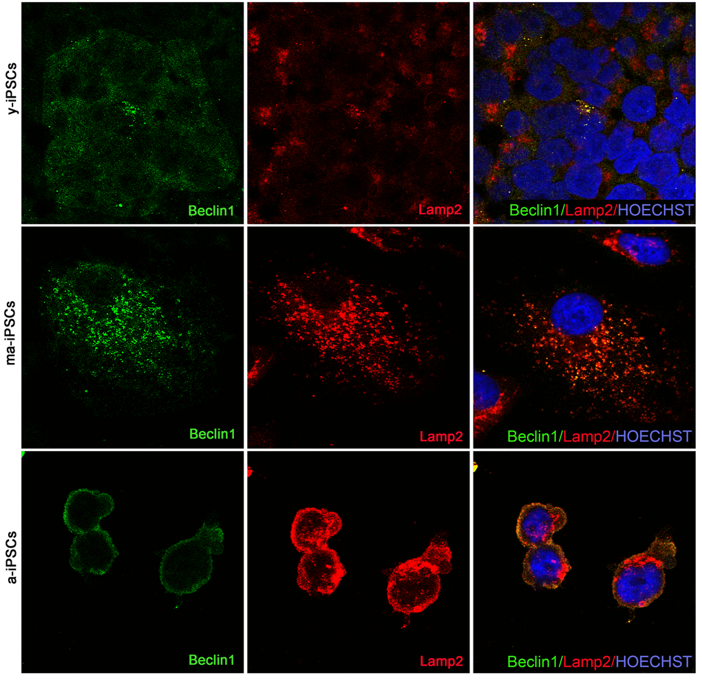 Confocal microscopy of y-, ma- and a-iPSCs immunostained with Beclin1 (in green), Lamp2 (in red) and Hoechst (in blue). In ma-iPSCs the central cell shows a granular distribution of Lamp2, while the arrow indicates a cell with a perinuclear staining similar to those observed in a-iPSCs.