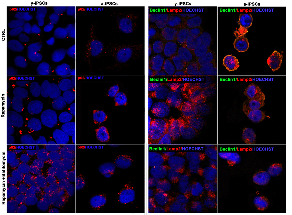 Confocal microscopy of y- and a-iPSCs stained with anti-p62 antibody (in red), anti-Beclin1 (in green), Lamp2 (in red) and Hoechst (in blue), treated with rapamycin alone or in combination with bafilomycin.