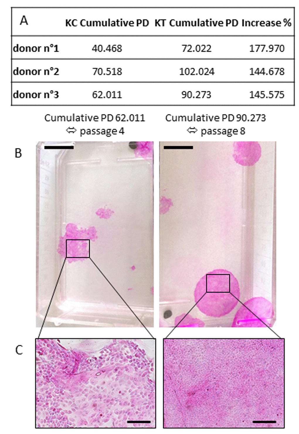 Influence of Selenium on replicative senescence. (A) Cumulative population doubling corresponds to the sum of population doubling over subculture passages until the last passage with holoclones. The percent increase is calculated as (KT Cumulative PD/KC Cumulative PD) x100 (KT: treated keratinocytes; KC: control keratinocytes). CFE was calculated at each passage over replicative life span where keratinocytes are still able to produce holoclones. (B) Example of colony morphology corresponding to the last cumulative PD/passages with holoclones. (Scale bar = 1cm) (C) Representative morphology of supplemented keratinocytes (small, cohesive and cobblestone keratinocytes) or control keratinocytes (senescence-associated phenotype with differentiated cells) at a late passage. Representative photographs are shown (scale bar=500 µm; n=3 donors).