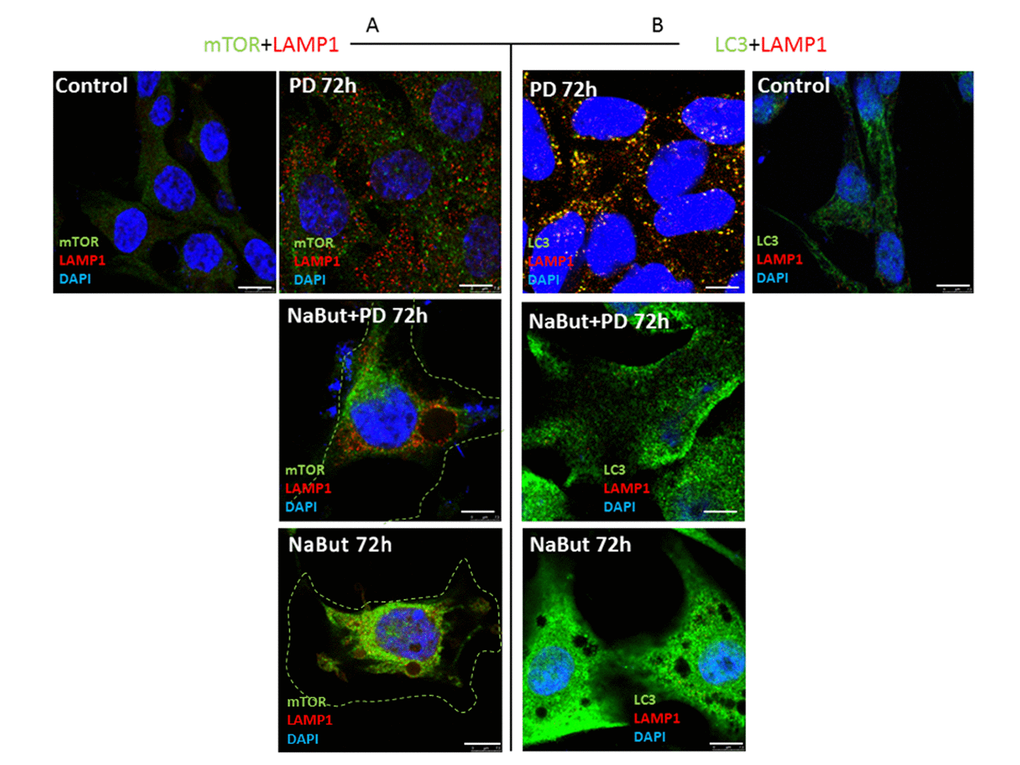 Spatial uncoupling of lysosomes and autophagosomes in senescent cells blocks their fusion upon activation of autophagy by MEK-ERK inhibition. Immunofluorescent images showing LAMP1 (red) and mTOR (green) perinuclear localization in senescent cells and in senescent cells upon MEK/ERK suppression. Cells were treated with inhibitors for 72 h, then fixed and stained with antibodies against LAMP1/mTOR (A) and LAMP1/LC3 (B). Green dotted lines show borders of senescent cells (A). Right panel (B) shows the actual size of senescent cells according to LC3 fluorescence. LAMP1 colocalizes with LC3 in control cells exposed to PD and does not colocalize in senescent cells. Nuclei stained with DAPI (blue). Scale bars: 7,5 µm.
