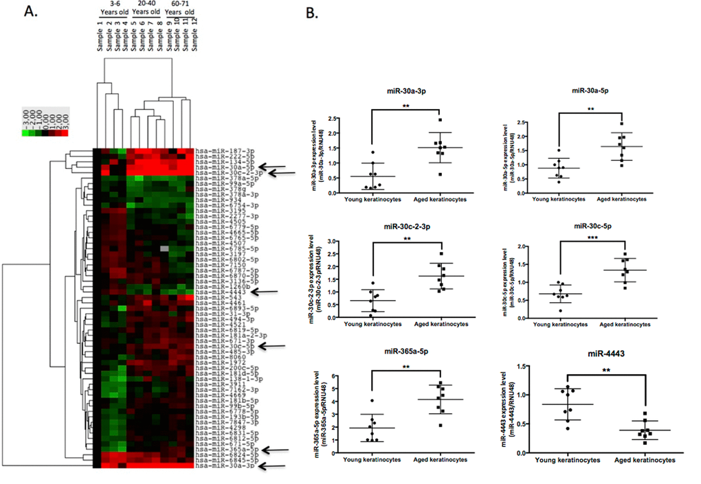 A large-scale expression screen identifies microRNAs modulated by aging in human keratinocytes. (A) Hierarchical clustering of miRNA differentially expressed in keratinocytes from four infants (3-6 years), four young adults (20-40 years) or four aged adults (60-71 years). Green color corresponds to underexpression and red color to overexpression. The data are normalized to the first infant sample. (B) QPCR Validation of 6 modulated microRNAs indicated by arrows in the clustering data: miR-30a-3p, miR-30a-5p, miR-30c-2-3p, miR-30c-5p, miR-365a-5p, and miR-4443 expression levels were analyzed by QPCR in 8 independent cultures of keratinocytes from young and aged donors. Results are mean +/- SD from three independent samples. **P