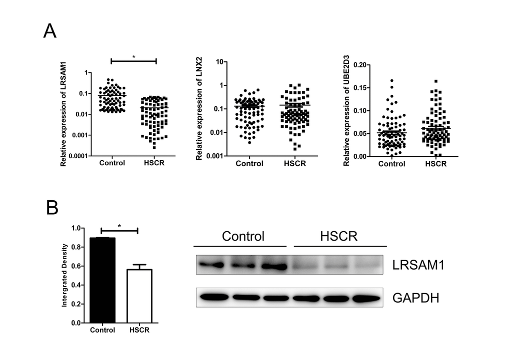 LRSAM1 was down-regulated in HSCR samples. (A) The expression of LRSAM1 significantly decreased in HSCR (n=80) tissues compared with control samples (n=80) in mRNA level. No significant difference of LNX2 or UBE2D3 was observed between HSCR and control. (B) The protein expression level of LRSAM1 in HSCR tissues and controls. *indicates significant difference compared with control group, P