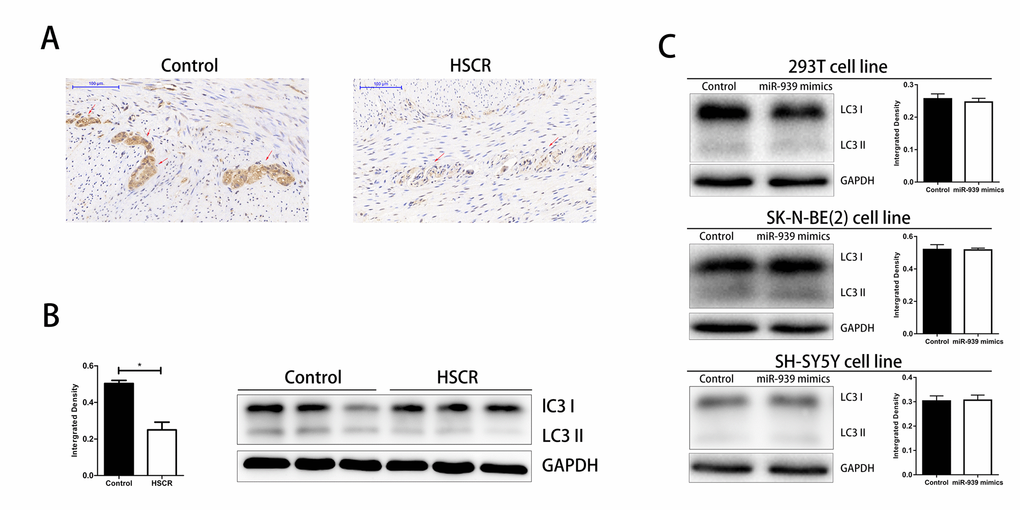 Downregulated level of autophagy in HSCR. The autophagy was significantly suppressed in HSCR via detecting the expression of LC3 through IHC (A) and WB (B). (C) Autophagy level was not changed when mir-939 was upregulated by mimics. *indicates significant difference compared with control group, P