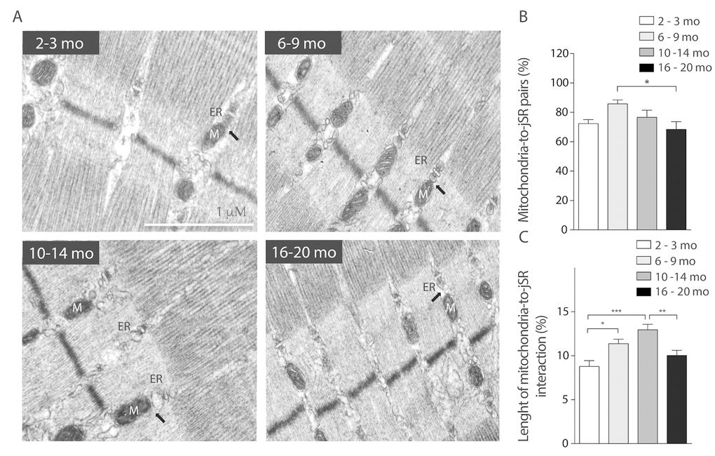 SR-mitochondria coupling are decreased in aged mice. (A) Representative images of electron microscopy 20.000X from FDB longitudinal slices of mice from the different groups. (B) Analysis of ER- mito contacs in percentage shows a significant decrease of these structures in the older group when compared to the 6-9 months old group. (C) Length of the SR- mito interface is significantly increased in the adult group and significantly decreased in the old group.