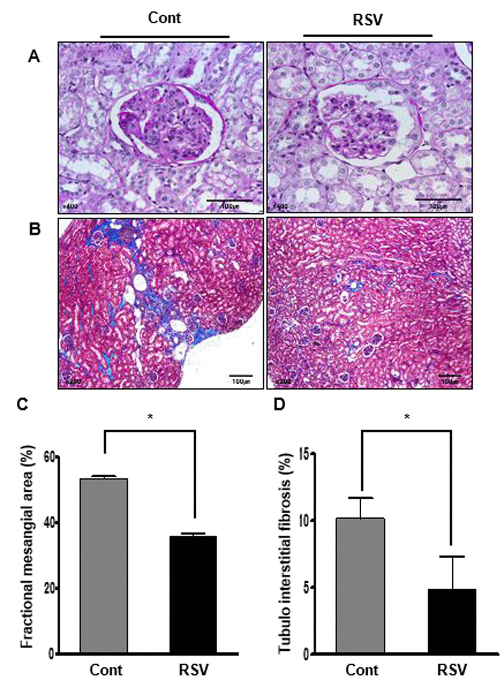 Effects of resveratrol on aging-related histological renal injury. Less expansion of the mesangial area (A; periodic acid–Schiff (PAS), original magnification ×400) and significantly less tubulointerstitial fibrosis (B; Masson’s trichrome, original magnification ×200) were found in the RSV group compared to that in the control (Cont) group. Quantitative assessment of the areas of extracellular matrix in the glomerulus (C) and tubulointerstitial fibrosis (D) in the control and RSV groups, respectively. (*P