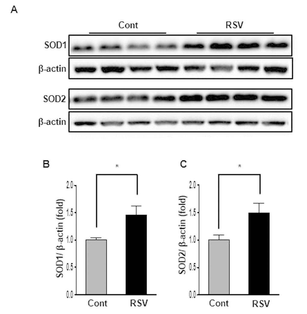 Effects of resveratrol on the expression of SOD1 and SOD2. Representative western blots of SOD1 and SOD2 protein levels. (A). Expression of SOD1 and SOD2 was significantly increased in the RSV group compared to that in the control (Cont) group (B, C). Quantitative analysis of the results is shown (*P