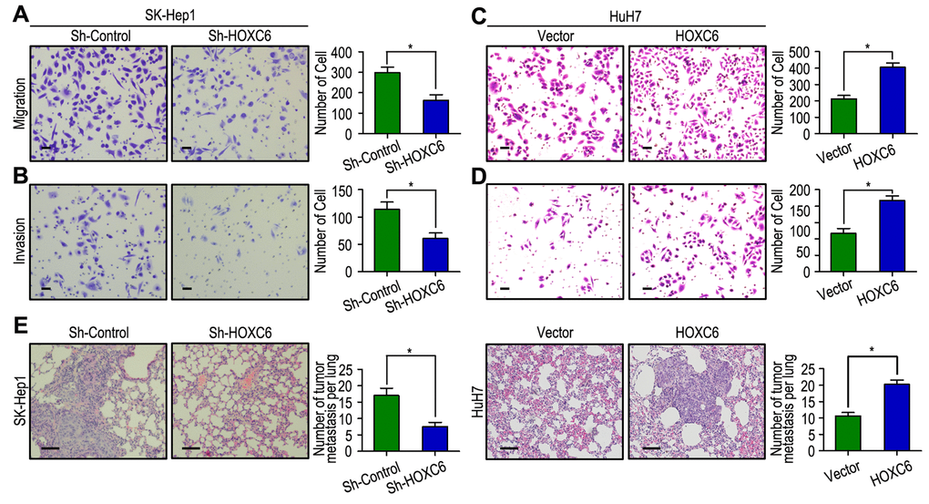 HOXC6 promotes cell migration and invasion in HCC cell lines. (A, B) HOXC6 silenced in SK-Hep1 cells and inhibited cell migration and invasion. (C, D) HOXC6 up-regulated in HuH7 cells and promoted cell migration and invasion. (E) Lung H&E staining of nude mice inoculated SK-Hep1 and HuH7 transfected cells via tail vein. The number of lung metastatic foci in each group were also calculated, * P 