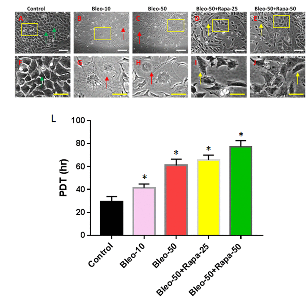 Proliferation of rabbit AFSCs cultured in growth medium with five different conditions for 6 days. (A, F) Growth medium only (Control); (B, G) bleomycin 10 μg/ml (B-10); (C, H) bleomycin 50 μg/ml (B-50); (D, I) Bleomycin 50 μg/ml and rapamycin 25 nM (B-50 + R-25); (E, J) Bleomycin 50 μg/ml and rapamycin 50 nM (B-50 + R-50); (L) Population doubling time (PDT) of AFSCs grown in five different conditions for 6 days. The images of F, G, H, I, J were enlarged areas of the boxes in images of A, B, C, D, E. Bleomycin treatment changed the morphology of AFSCs from cobblestone-like cells (green arrows in A, F) to pancake-like cells (red arrows in B, C, G, H), and also decreased proliferation of AFSCs as evidenced by population doubling time (L). However, the addition of rapamycin into bleomycin-containing medium decreased pancake-like cell numbers and increased spindle-like cell numbers (yellow arrows in D, E, I, J). White bars: 100 μm, yellow bars: 50 μm. *p