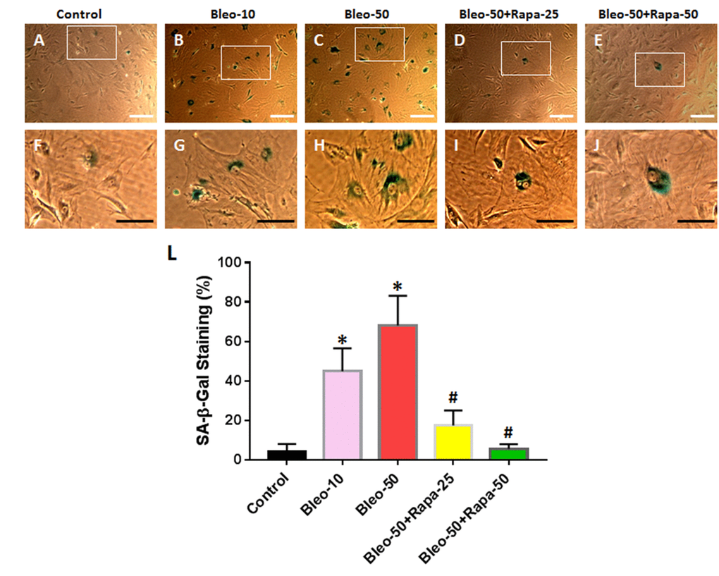 Senescence of rabbit AFSCs cultured in growth medium with five different conditions for 6 days and stained by histochemical staining kit. (A, F) Growth medium only (Control); (B, G) bleomycin 10 μg/ml (Bleo-10); (C, H) bleomycin 50 μg/ml (Bleo-50); (D, I) Bleomycin 50 μg/ml and rapamycin 25 nM (Bleo-50 + Rapa-25); (E, J) Bleomycin 50 μg/ml and rapamycin 50 nM (Bleo-50 + Rapa-50); (L) Semi-quantification of positive stained AF cells grown in five different conditions for 6 days. The images of F, G, H, I, J were enlarged areas of the boxes in images of A, B, C, D, E. The results indicated that bleomycin treatment induced the senescence of AF cells which was stained by green. Rapamycin decreased cell senescence induced by bleomycin. White bars: 100 μm, Black bars: 50 μm. *p