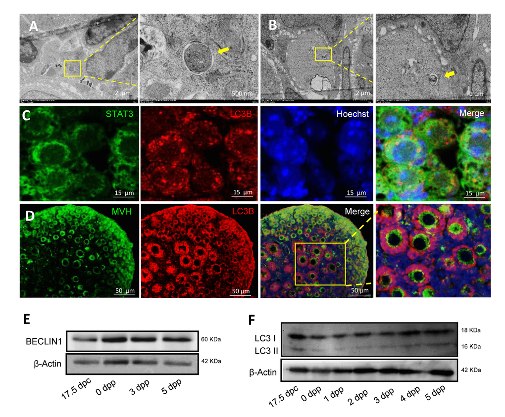 Morphological characteristics and expression of autophagic markers in mouse ovaries. (A) Observation of typical autophagosomes in 1 dpp mouse ovary by TEM. (B) Observation of typical autolysosome in 3 dpp mouse ovary by TEM. (C) Double IF staining for LC3B (red) and STAT3 (green) in 1 dpp mouse ovaries. (D) Double IF staining for LC3B (red) and MVH (green) in 3 dpp mouse ovaries. (E) WB detection for BECLIN1 in 17.5 dpc, 0 dpp, 3 dpp and 5 dpp mouse ovaries. (F) WB detection for BECLIN in 17.5 dpc, 0 - 5 dpp mouse ovaries.