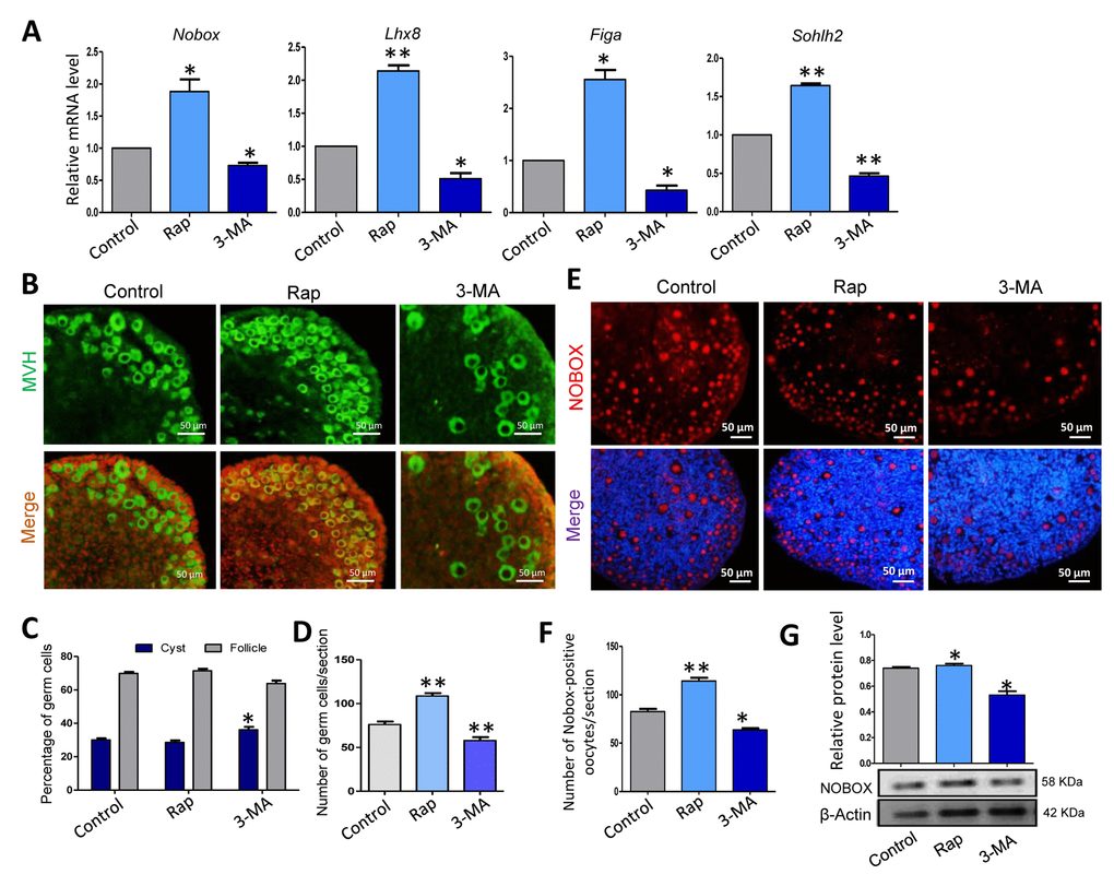 Rapamycin-promoted autophagy and prevented germ cell over loss after 5 days of treatment. (A) Quantitative RT-PCR for Nobox, Lhx8, Figa and Sohlh2 mRNA levels in control, rapamycin and 3-MA treated ovaries for 5 days. (B) IF staining for MVH (green) of control, rapamycin and 3-MA treated mouse ovaries for 5 days. (C) Percentage of germ cells in cysts and follicles in the three groups after 5 days treatment. (D) Average number of survived oocytes in the three groups. Autophagy leads to more survival of gem cells. (E-F) Number of NOBOX-positive oocytes/section in control, rapamycin and 3-MA treated ovaries. (G) Level of NOBOX protein in control, rapamycin and 3-MA treated ovaries. The results are presented as mean ± SD. * P 