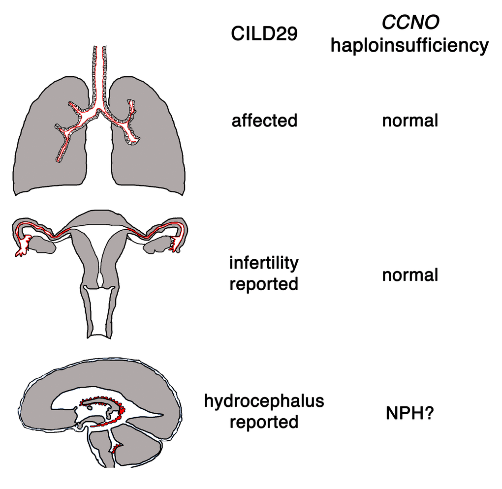 Consequences of complete or partial loss of CCNO. CCNO is involved in the generation of motile cilia in the MCCs of the respiratory airways, the Fallopian tubes and in the ependymal cells. CCNO mutations result in CILD29, a human syndrome characterized by the destruction of the lung parenchyma, female infertility and hydrocephalus. Most Ccno-/- mice and some Ccno+/- siblings develop communicating hydrocephalus. CCNO heterozygotes or carriers of hypomorphic mutations could constitute the molecular basis for idiopathic Normal Pressure Hydrocephalus (NPH). Epithelia containing MCCs are indicated with a red line.