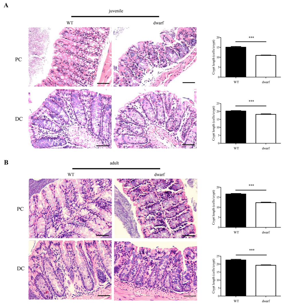 Colonic crypt length in dwarf mice. H&E staining sections of proximal colon (PC) and distal colon (DC) were used for evaluation of colonic crypt length. (A) Juvenile mice. Left panel, images of colonic crypts; right panel, cryptic cell number from 40 integrated crypts per mouse. (B) Adult mice. Left panel, images of colonic crypts; right panel, cryptic cell number from 40 integrated crypts per mouse. N=5; ***, P 