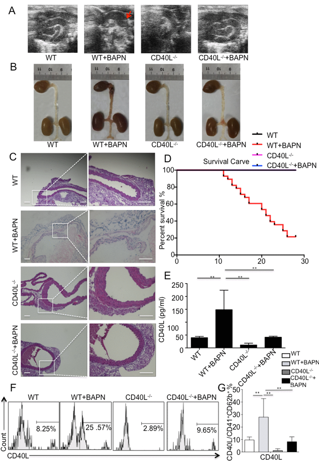 BAPN administration-induced TAD formation is inhibited by genetic depletion of CD40L. (A) Echography showed aortic arch dilation. (B) Representative images showed autopsy features of isolated mouse aorta after feeding with BAPN or saline for 28 days; arrow, location of TAD. (C) Haematixylin and eosin (H&E) staining showed significant dissected intima in WT+BAPN mice, while flat intima could be seen in other 3 groups. (D) Survival curve of WT (n=12), WT+BAPN (n=27), CD40L-/- (n=12) and CD40L-/-+BAPN (n=17) mice. (E) ELISA of sCD40L showed that circulating levels of CD40L are elevated in plasma from WT+BAPN mice. (F) Representative flow cytometry analysis showed percentage of CD41+ CD62b+ CD40L+ platelets divided by total CD41+ CD62b+ platelets in mice plasma. (G) Statistical data analysis from four separate experiments. Data were expressed as percentage ± SD of the CD41+ CD62b+ CD40L+ platelets subpopulations in total CD41+ CD62b+ platelets counted. **P 