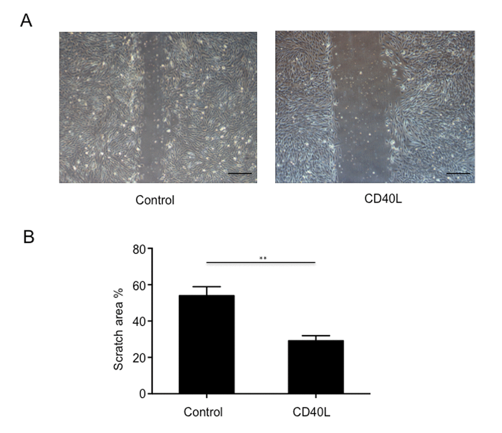 Endothelial cells migration was significantly inhibited by CD40L. (A) Representative images showed different scratch area in groups incubated with or without recombinant human soluble CD40 ligand. (B) Quantitative analysis showed significantly larger scratch area in wound area incubated with CD40L. Data were expressed as percentage ± SD. **P 