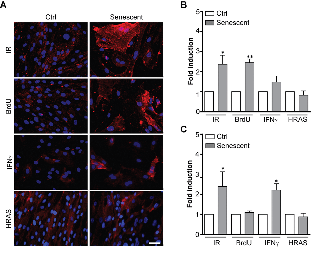 L1CAM expression in premature senescence induced by various stimuli. BJ fibroblasts were brought to premature senescence by γ-irradiation (PD 32, IR 20 Gy), 100 μM 5-bromo-2'-deoxyuridine (PD 32, BrdU), 500 U/ml IFNγ (PD35), or by induction of oncogenic HRAS using the Tet on system (see Materials and Methods). Cell surface expression of L1CAM estimated by live cell immunostaining with L1CAM antibody was detected microscopically (A) or (B) by FACS. The values representing three independent experiments are shown as a fold induction relative to control. (C) Real time RT-qPCR quantification of mRNA levels of L1CAM in BJ cells brought to premature senescence as in A. The values representing three independent experiments are shown as a fold induction relative to control. GAPDH was used as a reference gene. For statistics, two-tailed Student’s t-test was used; p ˂ 0.05 (*); p ˂ 0.01 (**); p ˂ 0.001 (***). Scale bar, 50 μm.