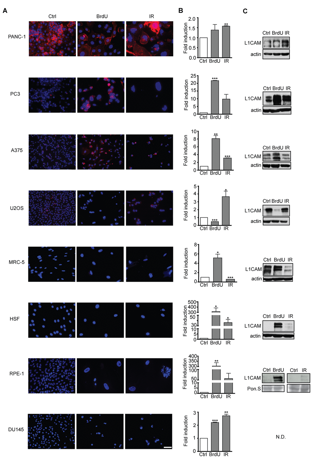L1CAM expression in normal and tumor senescent cells depends on the cell type and senescence-inducing stimulus. Normal (MRC5, HSF), immortalized (RPE-1) and tumor (PANC-1, PC3, A375, U2OS, and DU145) cells were brought to senescence either by BrdU (10 μM for A375, 100 μM for rest of cell types) or IR (10 Gy) and assayed for cell surface L1CAM protein expression by live cell immunostaining with L1CAM antibodies. (A) L1CAM mRNA expression by real time RT-qPCR quantification (B) and total L1CAM protein level by immunoblotting (C). GAPDH was used as a reference gene; β-actin was used as a loading control. The values representing two independent experiments are shown as a fold induction relative to control. N.D., not detected. Scale bar, 50 μm.
