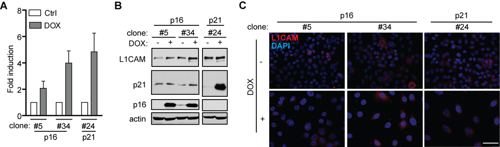 L1CAM expression is a downstream event linked to inhibition of cyclin-dependent kinases. L1CAM mRNA (A), total protein (B) and surface expression in control cells (ctrl; DOX-) and doxycycline-induced (DOX+) H28 cell clones #5, #34 (expressing p16) and #24 (expressing p21). L1CAM mRNA level was normalized to GAPDH. All experiments were performed in three independent replicates. Scale bar, 100 μm.