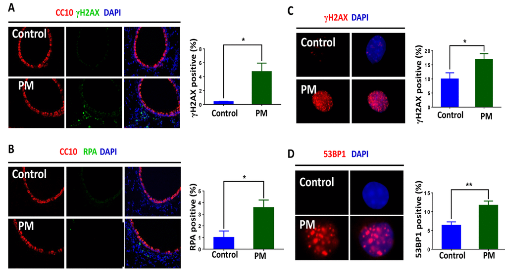 Particulate matter (PM) exposure induces DNA damage response (DDR) signaling in macrophages. C57/BL6 mice (n=3) were instilled intratracheally with PM at 100 μg·d-1 for 2 days in vivo. After 24 hours lung tissues were collected, and DNA damage response was analysed. (A) Representative image of γH2AX (red) in lung tissues. The average percentage of γH2AX positive cells to the total lung tissue cells with DAPI staining were quantified. (B) Analysis of RPA (red) in lung tissues. The average percentage of RPA positive cells to the total lung tissue cells with DAPI staining were quantified. (C) Representative immunofluorescence images of γH2AX (red) in bone marrow–derived macrophages (BMDMs) stimulated with PM at 100 μg·mL-1 for 24 hours. Cells with 5 or more foci were counted as positive. (D) Analysis of 53BP1 (red) in BMDMs treated with PM at 100 μg·mL-1 for 24 hours. Cells with 5 or more foci were counted as positive. All experiments were repeated at least 3 times, and data are presented as means ± SEMs. *p 