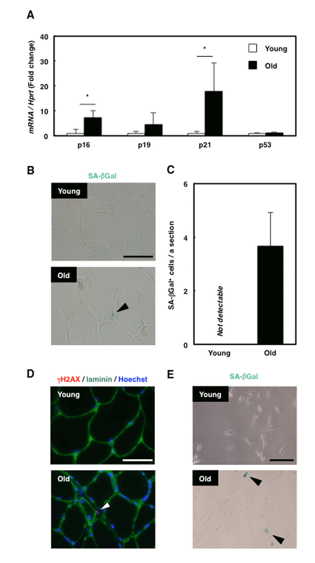 Senescent mesenchymal cells appeared in old rat skeletal muscle. (A) Quantification of mRNA levels of senescence markers in young and old rat skeletal muscle. Data are expressed as means±SE (n=4); *PB) SA-βGal staining in TA muscle sections from young and old rats. Black arrowhead: SA-βGal+ cell. Scale bar: 50 μm. (C) Quantification of SA-βGal+ cells per section. Data are expressed as means±SE (n=3). (D) Immunohistochemical analysis of γH2AX and laminin in TA muscle sections from young and old rats. White arrowhead: γH2AX+ cell. Scale bar: 50 μm. (E) SA-βGal staining of primary skeletal muscle cells from young and old rats. Black arrowheads: SA-βGal+ cells. Scale bar: 50 μm.