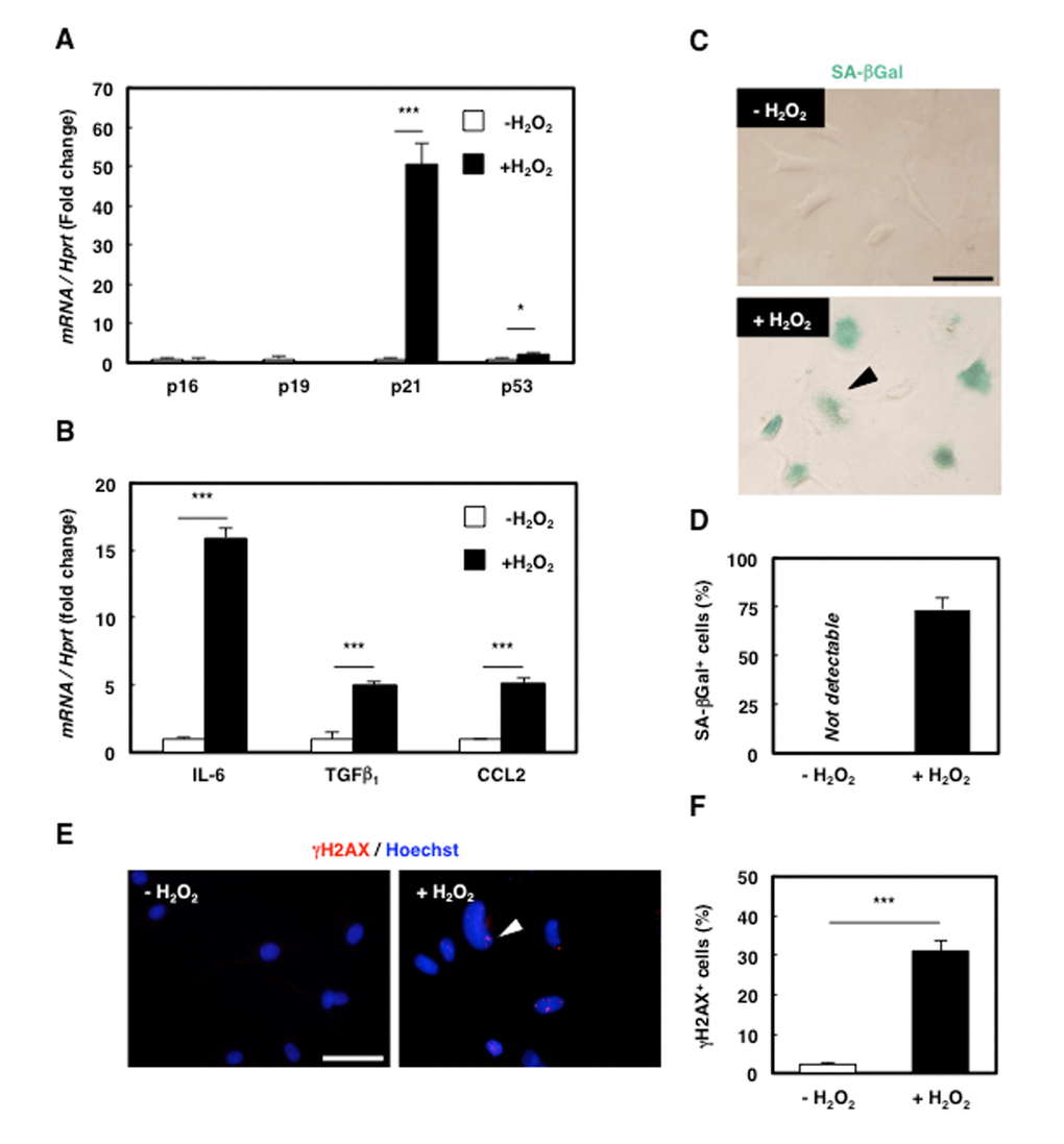 Senescence was successfully induced in rat mesenchymal cell clone 2G11 cells. (A) Quantification of mRNA levels of senescence markers in 2G11 cells treated with H2O2. Data are expressed as means±SE (n=3); *PPB) Quantification of mRNA levels of SASP markers in 2G11 cells treated with H2O2. IL-6: interleukin-6; TGFβ1: transforming growth factor β1; CCL2: C-C motif chemokine ligand 2. Data are expressed as means±SE (n=3); *PPC) SA-βGal staining in 2G11 cells treated with or without H2O2. Arrowhead: SA-βGal+ cell. Scale bar: 50 μm. (D) Quantification of SA-βGal+ cells. Data are expressed as means±SE (n=3). (E) Immunocytochemical analysis of γH2AX in 2G11 cells treated with or without H2O2. Arrowhead: γH2AX+ cell. Scale bar: 50 μm. (F) Quantification of γH2AX+ cells. Data are expressed as means±SE (n=3); ***P