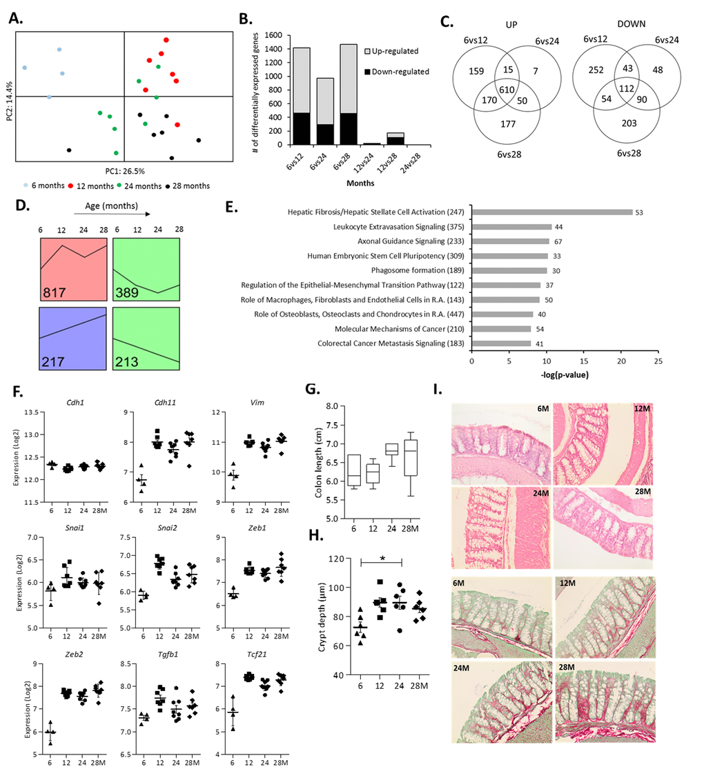 Changes in colonic gene expression in 6, 12, 24 and 28-month-old mice. (A) Principal Component Analysis (PCA) plot using the top 1,000 most variable genes showing the first 2 principal components. (B) The number of differentially expressed genes for all age comparisons (IBMT qC) Venn diagram showing the number of overlapping and unique differentially expressed genes between 6vs12, 6vs24 and 6vs28 months. (D) Each significantly differentially expressed gene (6vs12, 6vs24, 6vs28 months, qE) Top 10 most significant canonical pathways between 6 and 12 months as determined by Ingenuity Pathway Analysis (R.A. = Rheumatoid Arthritis). Numbers behind bars represent the number of differentially expressed genes (IBMT qF) The gene expression (Log2) of the epithelial marker E-cadherin (Cdh1), mesenchymal markers OB-cadherin (Cdh11) and Vimentin (Vim), transcription factors Snail Family Transcriptional Repressor 1 and 2 (Snai1, 2) and Zinc Finger E-Box Binding Homeobox 1 and 2 (Zeb1, 2), Transforming growth factor beta 1 (Tgfb1) and Transcription Factor 21 (Tcf21). (G) Length of the colon (cm) at sacrifice. (H) Depth of colonic crypts (μm) measured in H&E stained colon samples. (I) Representative pictures of Haematoxylin and Eosin (H&E) staining and Sirius Red/Fast Green staining of colon tissue at 6, 12, 24 and 28 months (200x magnification). Error bars reflect standard error of mean (S.E.M.). *p