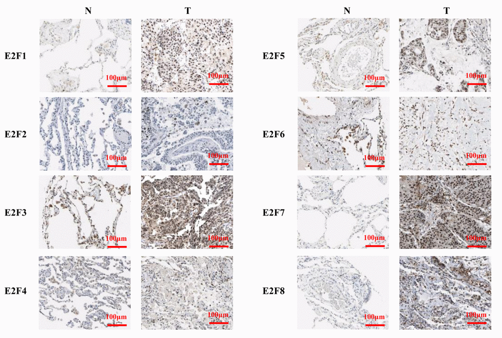 The expression of E2Fs in LC (IHC).