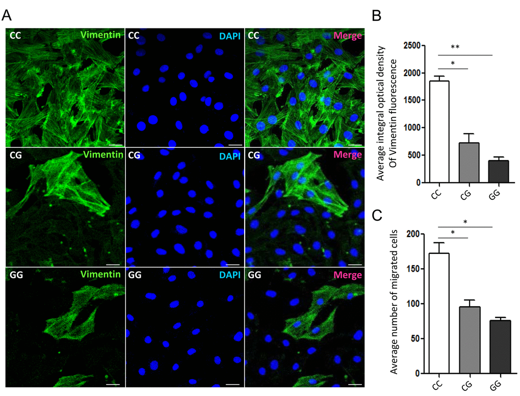 Vimentin organization and migration of GBM primary cells with different genotypes of rs11558961. (A) Representative confocal-microscopy graphs of immunostaining for Vimentin in rs11558961 CC, CG and GG cells. Green: Vimentin; Blue: DAPI. (B) Quantitative analysis of vimentin fluorescence in different groups. (C) Migration of cells with different genotypes. The experiment was repeated three times. Data were presented as mean ± SD. Scale bar = 50μm. *PP