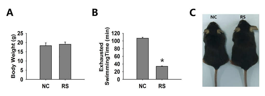 The general condition of both groups of mice. (A) Body weight was not significantly different in both groups. (B) The exhausted swimming time of the RS mice was markedly decreased compared to that of the NC group. (C) Representative photos of NC and RS group mice. *significantly greater at P