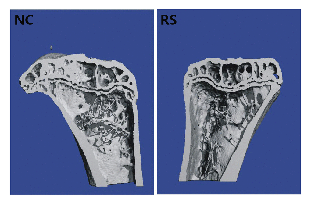 The architecture of trabecular bone of the left tibia in the NC group and RS group. The trabeculae separation was outstandingly increased in the tibia of the RS group mice compared with that of the NC group.