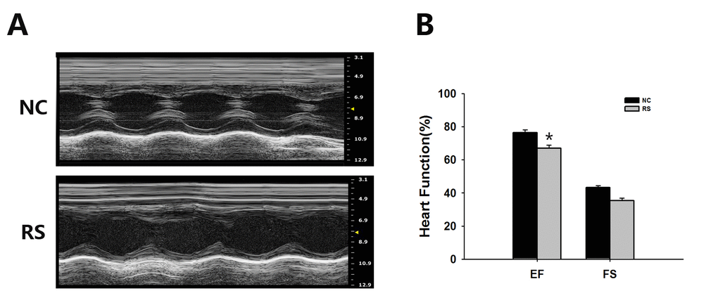 Ultrasound imaging planes analysis used for cardiovascular assessments of mice of the NC and RS groups. (A) The cardiovascular ultrasound imaging of the NC and RS groups. (B) Cardiac functions of the two groups were estimated by EF and FS. The EF in the RS group was decreased significantly compared with NC group.