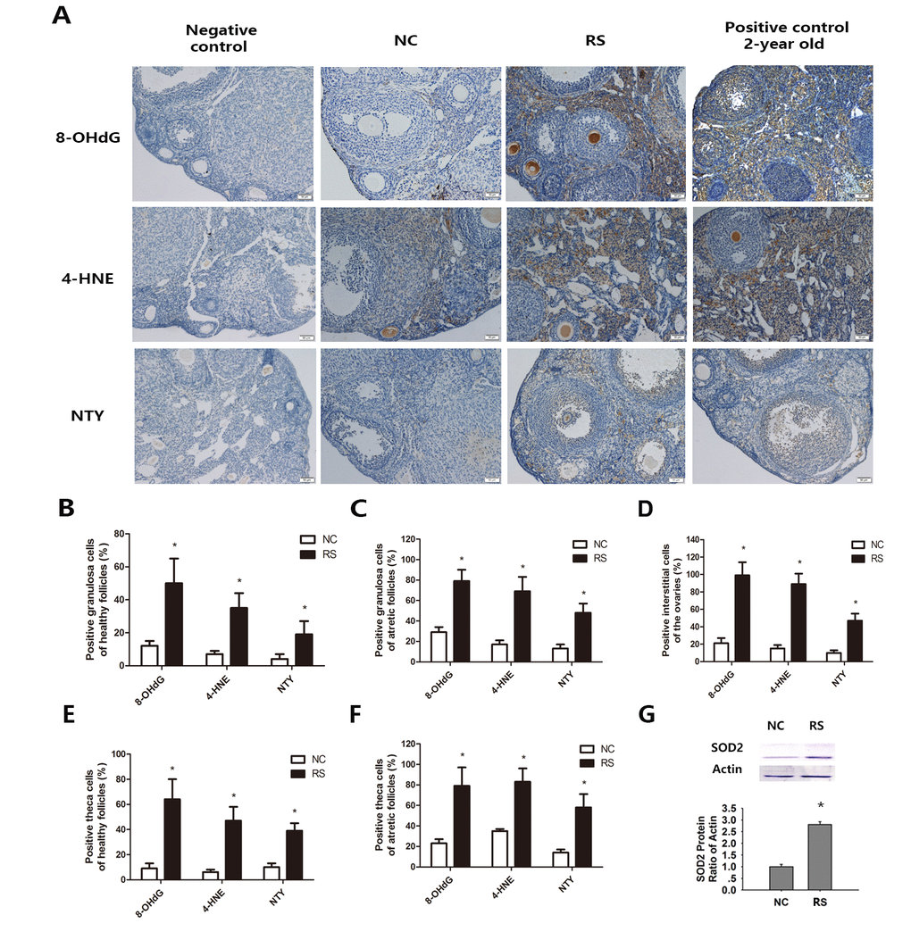 Effects of repeated superovulation on oxidative damage and antioxidant enzymes in both groups. Oxidative stress related oxidative damage in interstitial cells was scored using immunostaining for oxidative damage markers, as described in the Methods section. (A) Representative images of immunostaining (dark brown) for each oxidative damage marker in interstitial cells: Oxidative DNA damage (8-OHdG), lipid peroxidation (4-HNE) and protein oxidation (NTY) in the ovaries of the NC group, RS group and negative control and positive control groups. All original magnifications are x200. (B-C) The percentages of positive stained granulosa cells in healthy or atretic follicles. (D-E) The percentages of positive theca cells in the healthy or atretic follicles. (F) The percentages of positive interstitial cells in the ovaries. (G) The protein expression of the antioxidant gene SOD2 was significantly increased in the RS group. Values are expressed as the mean ± SEM. *P