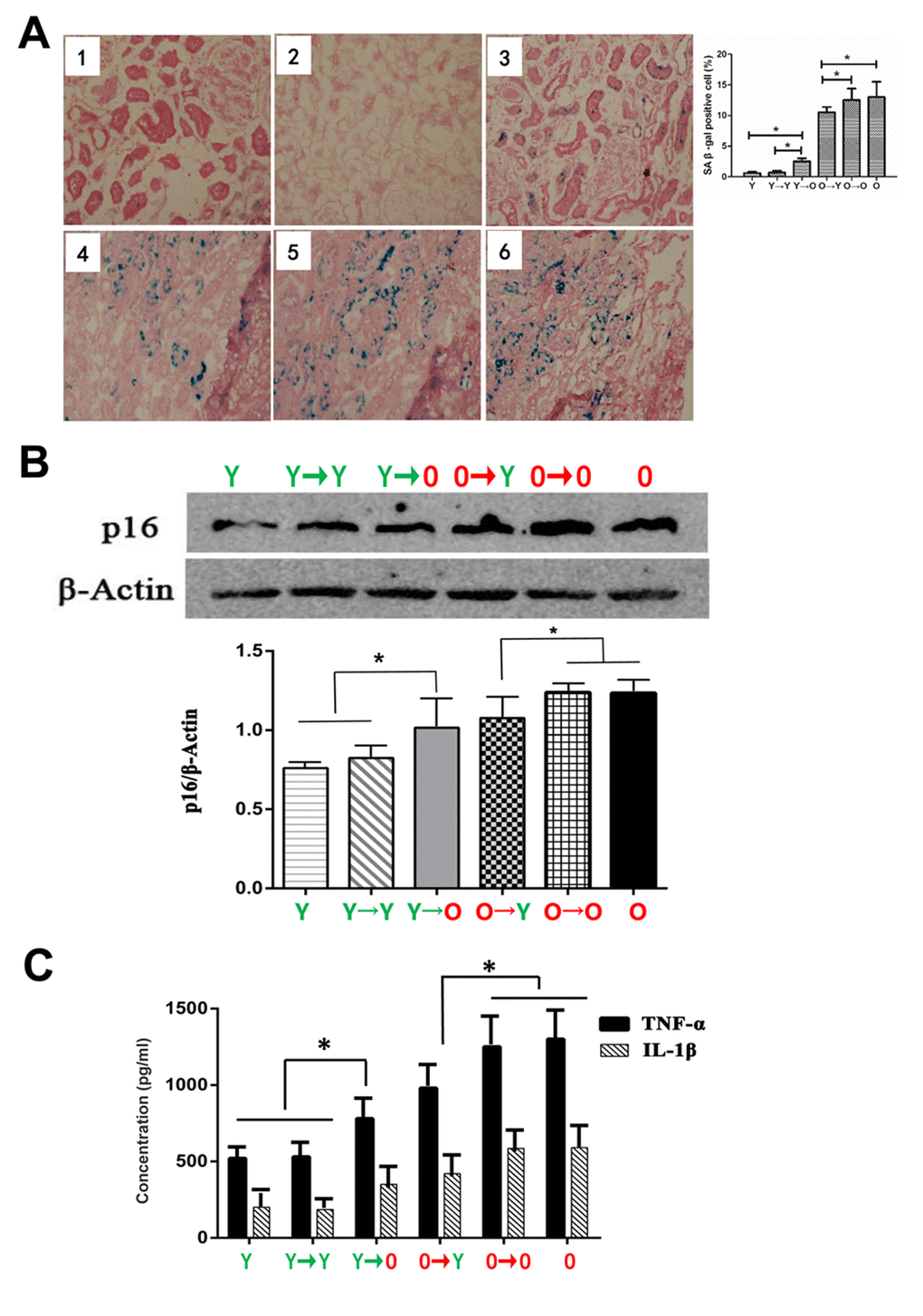 Levels of aging biomarkers. (A) SA-β-gal staining in each group (*p B) Western blot showing p16 expression levels (*p C) Results of specific ELISAs showing expression levels of TNF-α and IL-1β (*p 