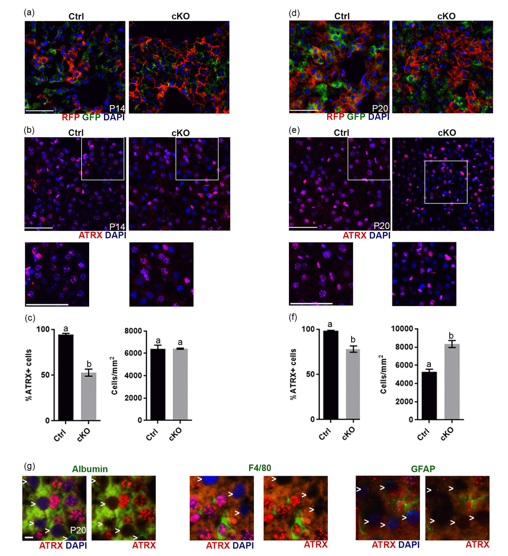 Evidence of Cre recombinase expression and Atrx deletion in a subset of hepatocytes in Atrx Foxg1cre (cKO) mice at P14 and P20. (a) Immunofluorescence detection of RFP and GFP in Atrx Foxg1cre;ROSAmT/mG mice reveals Cre-mediated GFP expression (b) ATRX immunofluorescence of liver cryosections at P14 shows that many nuclei do not express ATRX protein. White box outlines magnified area below. Scale bar = 50 µm. Representative image of n=3 Ctrl/cKO pairs. (c) Cell counts of ATRX+ cells reveal a significant reduction in the proportion of ATRX+ cells in Atrx Foxg1cre compared to control liver at P14 despite equal number of cells. (d) Immunofluorescence detection of RFP and GFP in P20 liver of Atrx Foxg1cre; ROSAmT/mG mice shows expression of shows Cre-mediated GFP expression. (e) ATRX staining in liver cryosections at P20 shows presence of ATRX-null nuclei and the accumulation of bright ATRX+ cells. White box outlines magnified area below. Scale bar = 50 µm. (Representative images from n=3 Ctrl/cKO pairs). (f) Cell counts show a significant reduction in the proportion of ATRX+ cells and increased total cell density in Atrx Foxg1cre liver at P20 compared to controls (g) Immunofluorescence staining of P20 Atrx Foxg1cre liver shows that cells lacking ATRX co-stain with albumin (hepatocytes) but not with F4/80 (Kupffer cells) or GFAP (stellate cells). White arrows point to ATRX-null nuclei. Scale bar = 5 µm. Original magnification, 40x. In graphs (c) and (f), groups with the same letter have means that are not significantly different and groups with different letters have means that are significantly different (p