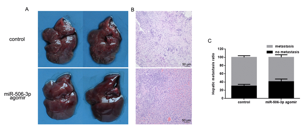 MiR-506-3p inhibits HOS cell invasiveness in vivo. (A, B). Livers were dissected and macroscopically photographed or stained with hematoxylin and eosin. (C) Statistical results for the number of metastasis.