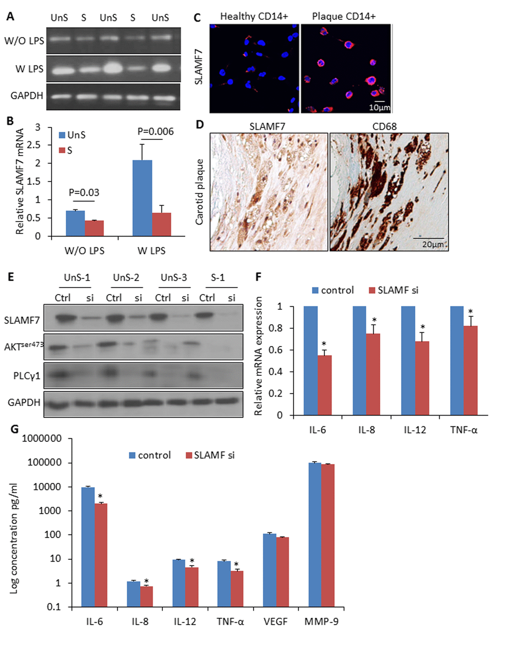 High expression of SLAMF7 in CD14+ plaque monocytes stimulates proinflammatory cytokine production. (A) CD14+ macrophages were isolated from human atherosclerotic plaques, and cultured for 24 hours. SLAMF7 mRNA was detected by RT-PCR with or without LPS (10ng/ml) stimulation for 3 hours. (B) Quantification of the SLAMF7 mRNA expression in UnS vs. S plaques. P=0.03 W/O LPS, P=0.006 W LPS, by student’s t test. (C) Immunofluorescent staining of SLAMF7 in CD14+ cells from healthy donor and one UnS plaque. (D) Immunohistochemistry staining of SLAMF7 in adjacent sections with anti-SLAMF7 and CD68 antibodies, respectively. (E) Transduction with specific siRNAs targeting SLAMF7 (SLAMF7 siRNA, 200nM) in the plaque-derived CD14+ cells for 24 hours resulted in a significant suppression of protein expressions of SLAMF7, AKTser473 and PLCγ1 by Western Blot analyses. (F-G) Transduction with SLAMF7 siRNAs in the plaque-derived CD14+ cells for 24 hours resulted in a significant reduction of proinflammatory cytokines IL-6, IL-8, IL-12 and TNF-α measured by RT-PCR (F) and ELISA (G). Independent experiments were done on CD14+ monocytes from 4 different donors and the results are shown as mean ± SD. *P