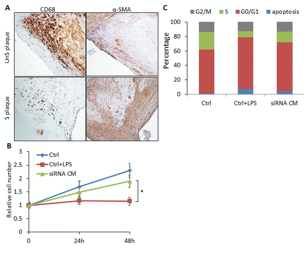 SLAMF7 mediates reduced proliferation of VSMCs in the UnS plaque. (A) Representative immunohistochemistry staining images showing lower prevalence of VSMCs compared to the CD68+ macrophages in UnS plaques than in S plaques. (B) 5 × 104 VSMCs were plated in 6-well plates, serum starved overnight, and cultured with conditioned medium (CM) from human CD14+ macrophages. Ctrl: VSMCs were treated with CM from CD14+ cells transfected with control siRNA; Ctrl+LPS: VSMCs were treated with CM from LPS stimulated control siRNA CD14+ cells; siRNA CM: VSMCs were treated with CM from SLAMF7 siRNA CD14+ cells stimulated with LPS. After 24 and 48 h, cells were harvested and counted by hemocytometer. *P C) Cell cycle distribution of VSMCs treated with CM.