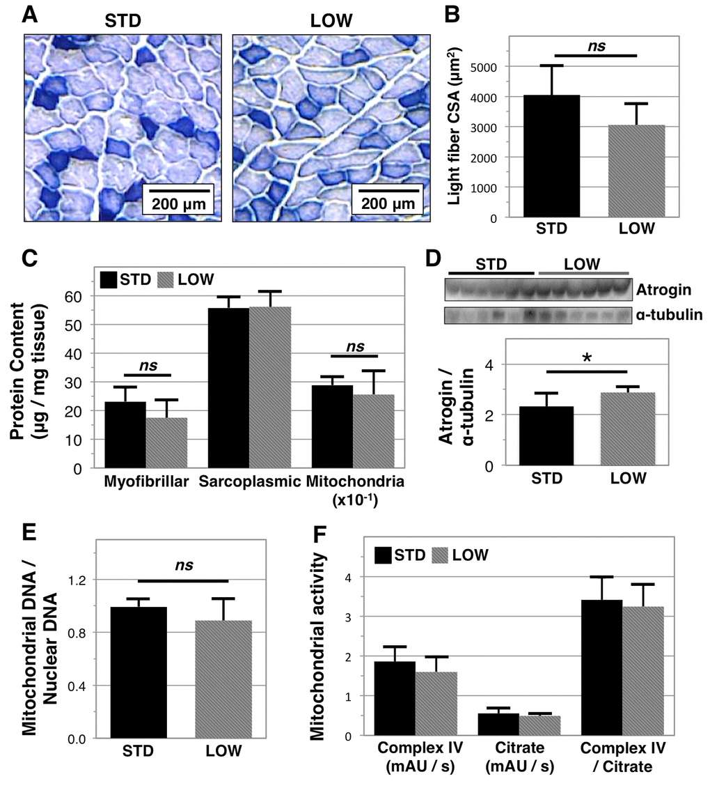 Analysis of muscle quality in vitamin D sufficient and insufficient mice. To assess impacts of vitamin D insufficiency on muscle biology, tissues were harvested following 12 months of sufficient (STD) or insufficient (LOW) supplementation. Quadriceps muscle was then analyzed with NADH staining (A) allowing for quantification of the cross-sectional area (CSA) of light stain fibers that corresponds to fast twitch fibers, n=5, 4 respectively (B). Gastrocnemius muscle was analyzed by differential centrifugation to determine myofibrillar, sarcoplasmic, and mitochondrial protein content, n=6 (C). Atrogin-1 expression was also determined in gastrocnemius muscle with western blotting and relative expression (atrogin / tubulin) was quantified using ImageJ software, n=6 (D). Mitochondrial biomass (E) and activity (F) in soleus muscle, n=6, were determined by quantitative PCR and biochemical assays, respectively. Statistical significance indicated by “*” p “ns” indicating non‑significance.