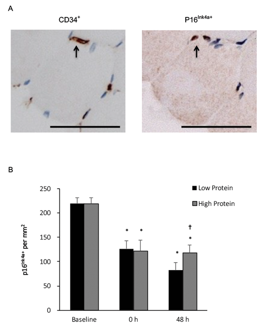 Senescent endothelial progenitor cells (p16Ink4a+/CD34+) in human skeletal muscle after resistance exercise. (A) Representative immunohistochemical co-staining of muscle cross-sections (senescent cells indicated by arrows). Scale bar 55 μm. (B) Senescent endothelial progenitor cells decreased in human skeletal muscle after a single bout of resistance exercise, and to a greater extends under low protein supplemented condition. * Significant difference against Baseline, P 